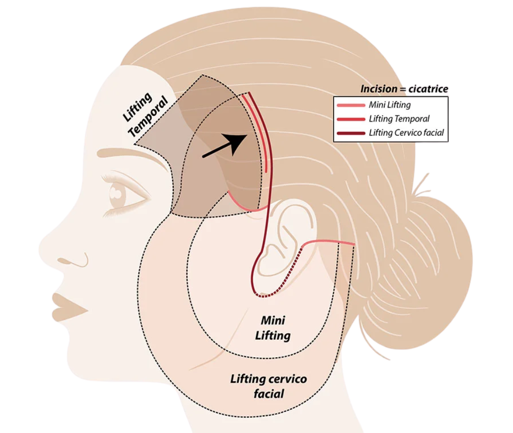 Lifting cervico-facial HC Aesthetics hc aesthetics-cabinet- cervico-facial 3