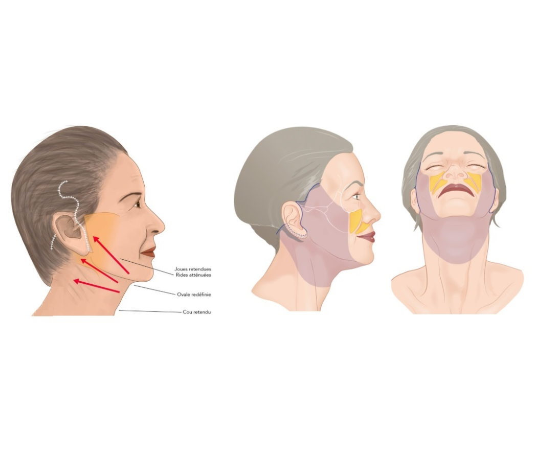 hc aesthetics-cabinet- cervico-facial hc aesthetics-cabinet- cervico-facial