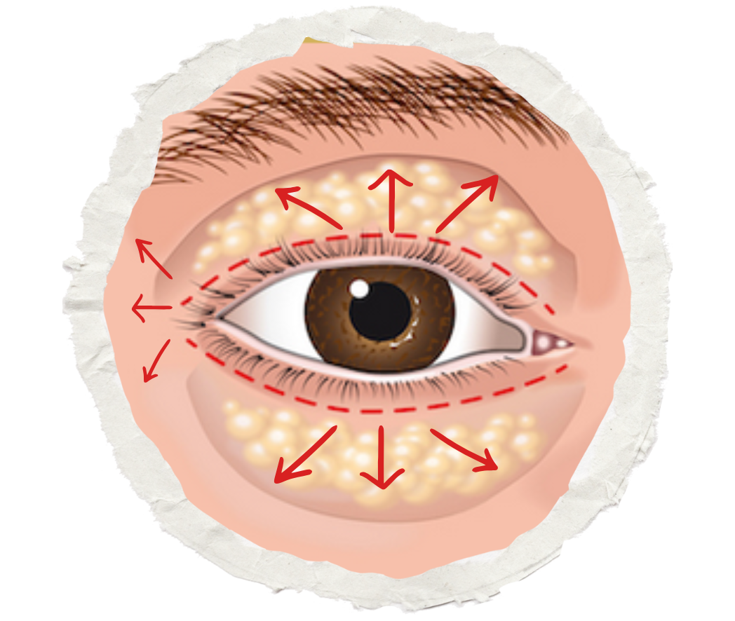 Chirurgie des paupières HC Aesthetics hc aesthetics-cabinet-blepharoplastie icon
