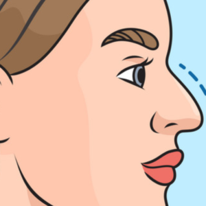 hc aesthetics-cabinet-rhinoplastie (7)