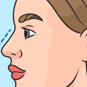 hc aesthetics cabinet rhinoplastie 11 HC Aesthetics