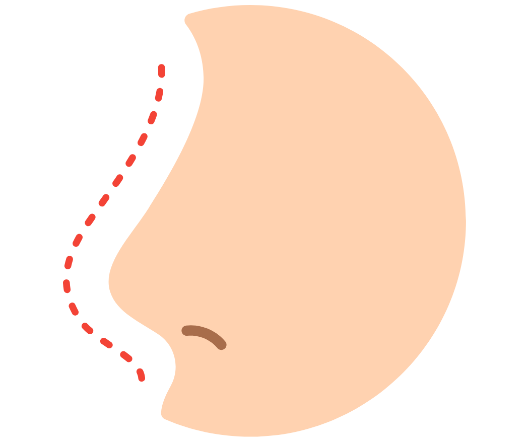 hc aesthetics-cabinet-Rhinoplastie