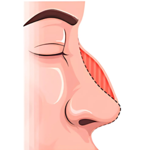 hc aesthetics-cabinet-Rhinoplastie