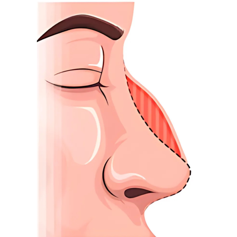 Rhinoplastie HC Aesthetics hc aesthetics-cabinet-Rhinoplastie