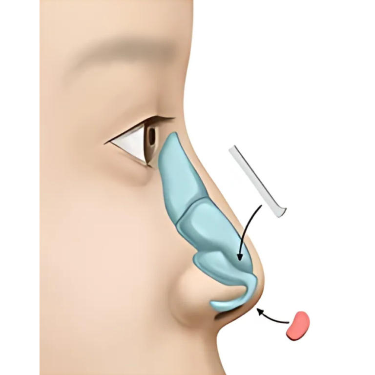 Rhinoplastie HC Aesthetics hc aesthetics-cabinet-rhinoplastie (7)