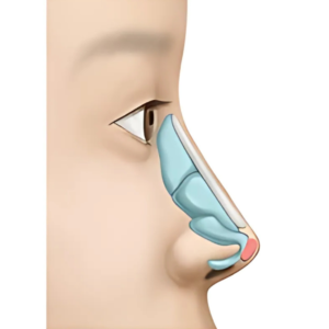hc aesthetics-cabinet-rhinoplastie (7)