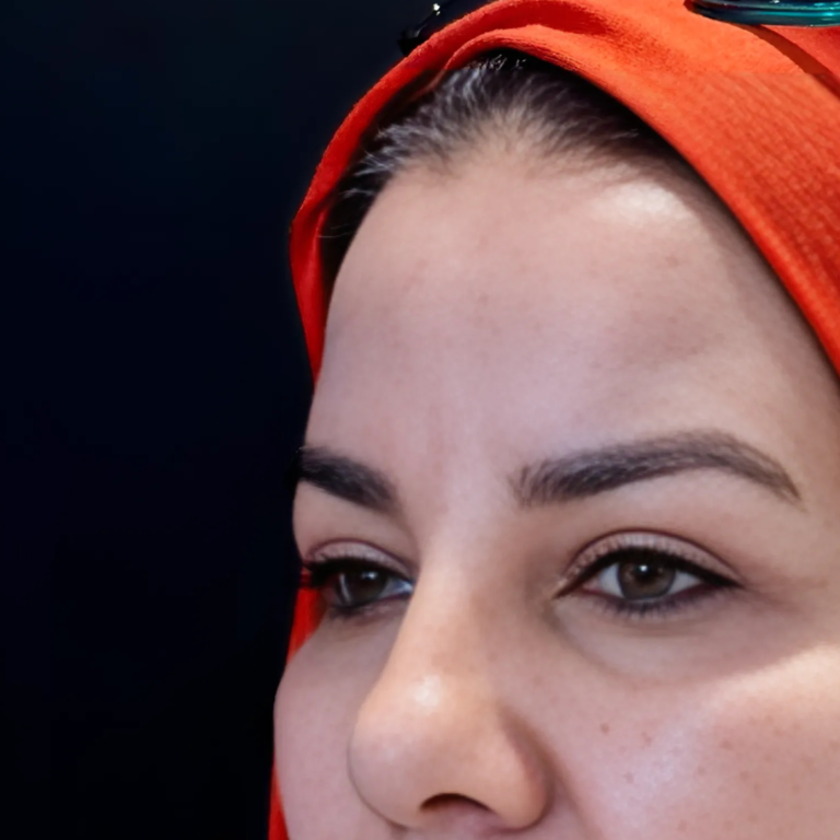 hcaesthetics- avant apres blepharoplastie superieur (5)