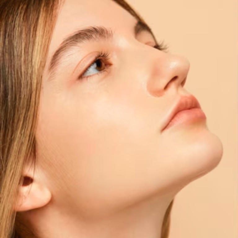 hcaesthetics- avant apres-rhinoplastie