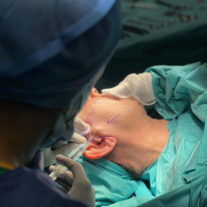 hcaesthetics Le lifting cervico facial intervention