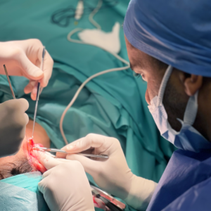 hcaesthetics Les cicatrices des procédures faciales intervention