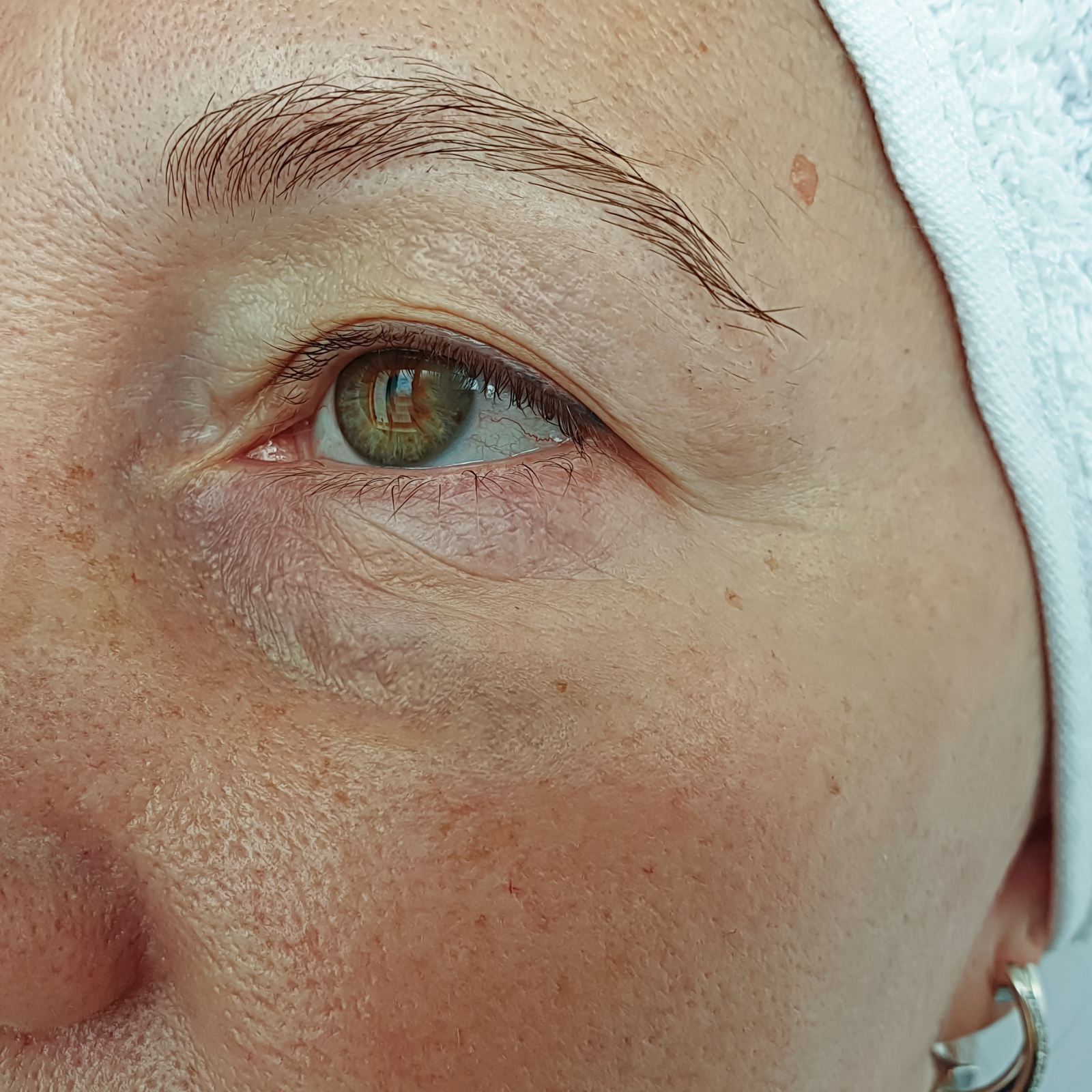 soin Hydrafacial & le Peeling soin Hydrafacial & le Peeling