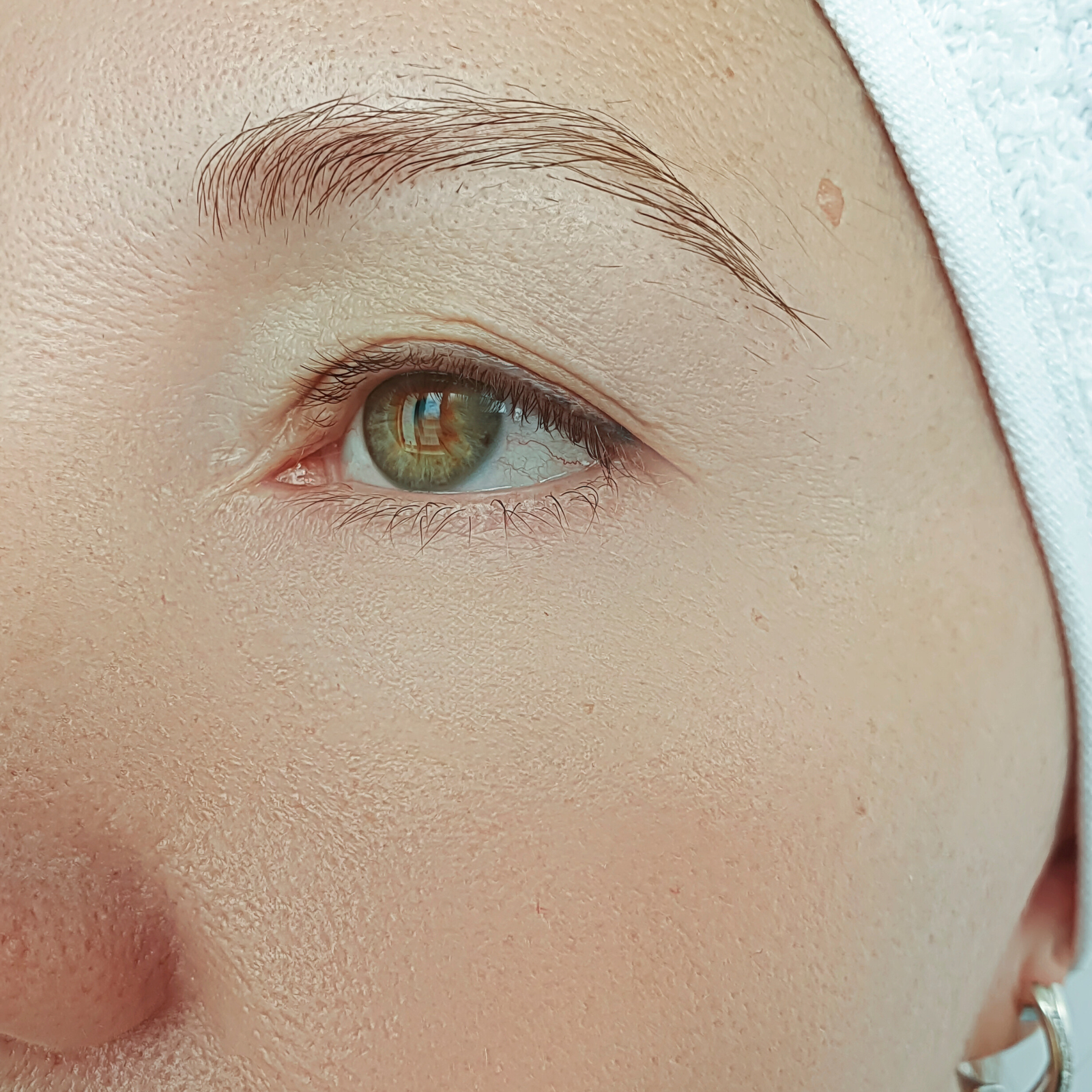 soin Hydrafacial & le Peeling soin Hydrafacial & le Peeling
