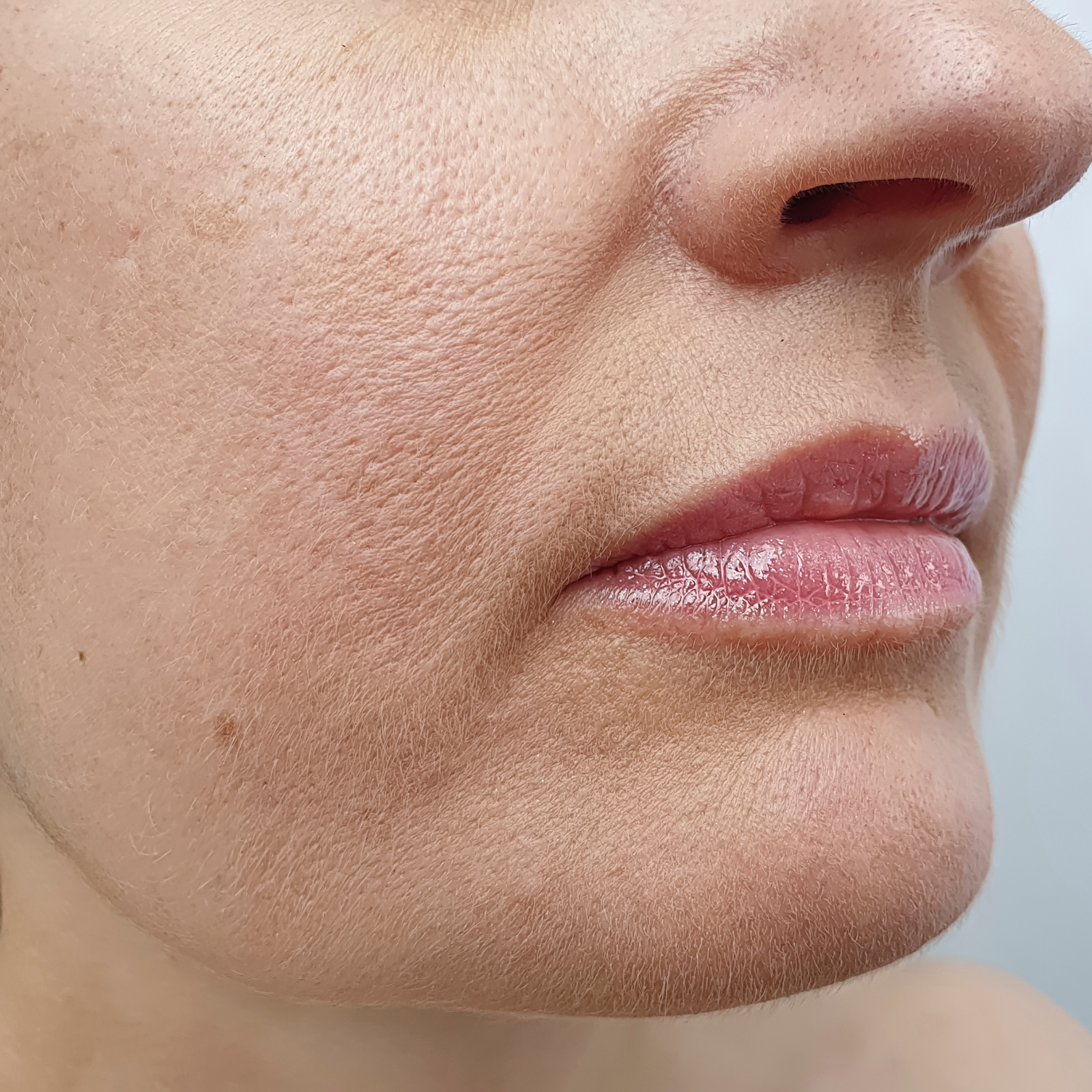 soin Hydrafacial & le Peeling soin Hydrafacial & le Peeling