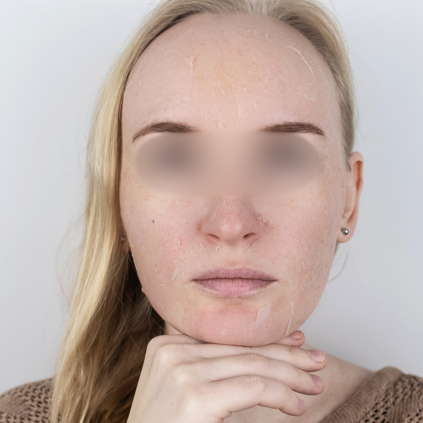 soin Hydrafacial & le Peeling soin Hydrafacial & le Peeling