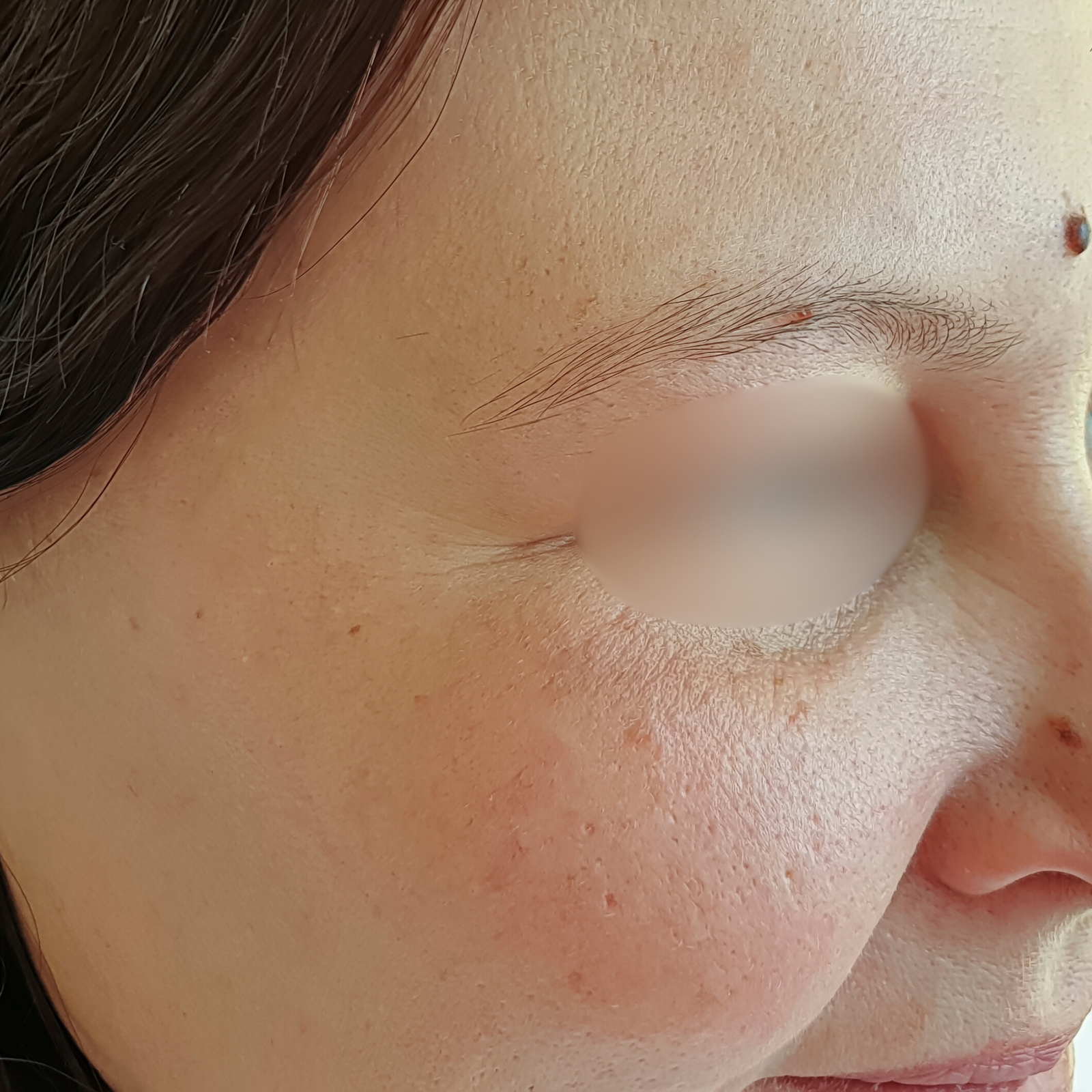 soin Hydrafacial & le Peeling soin Hydrafacial & le Peeling