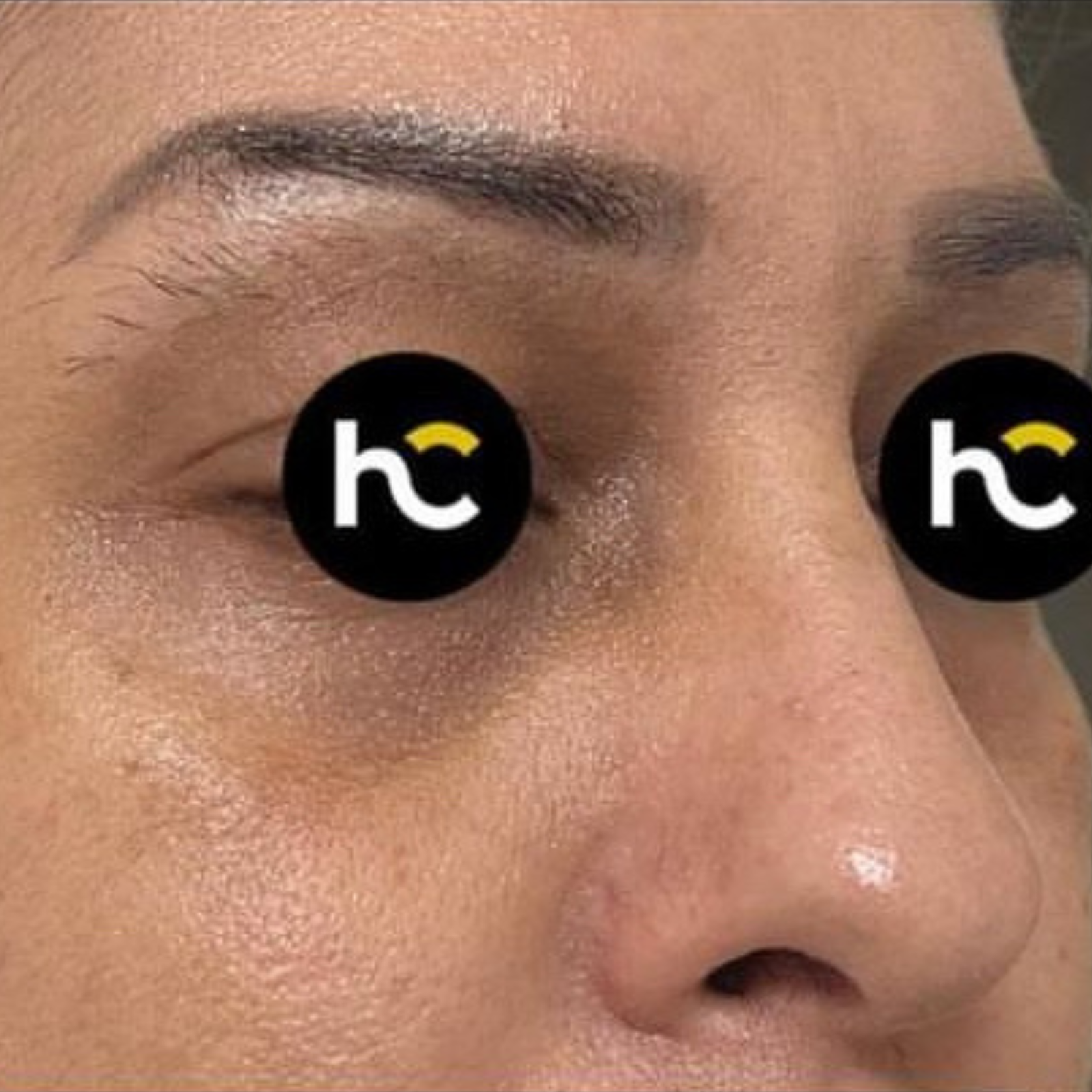 hc aesthetics-cabinet-lipofiling hc aesthetics-cabinet-lipofiling