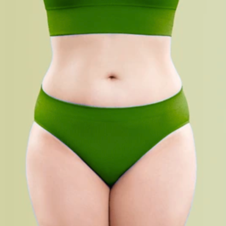 Résultats avant / après d’abdominoplastie à Casablanca