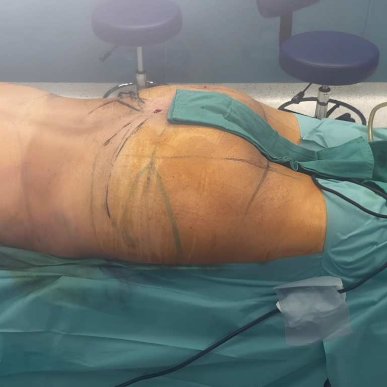 hc aesthetics-cabinet-BBL