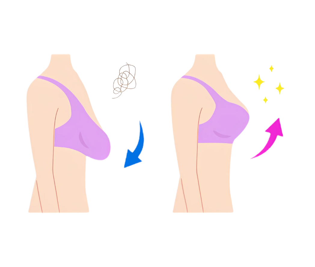 hc aesthetics-cabinet-Ptose mammaire