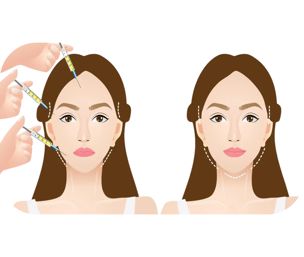 Lipofilling HC Aesthetics hc aesthetics-cabinet-lipofiling