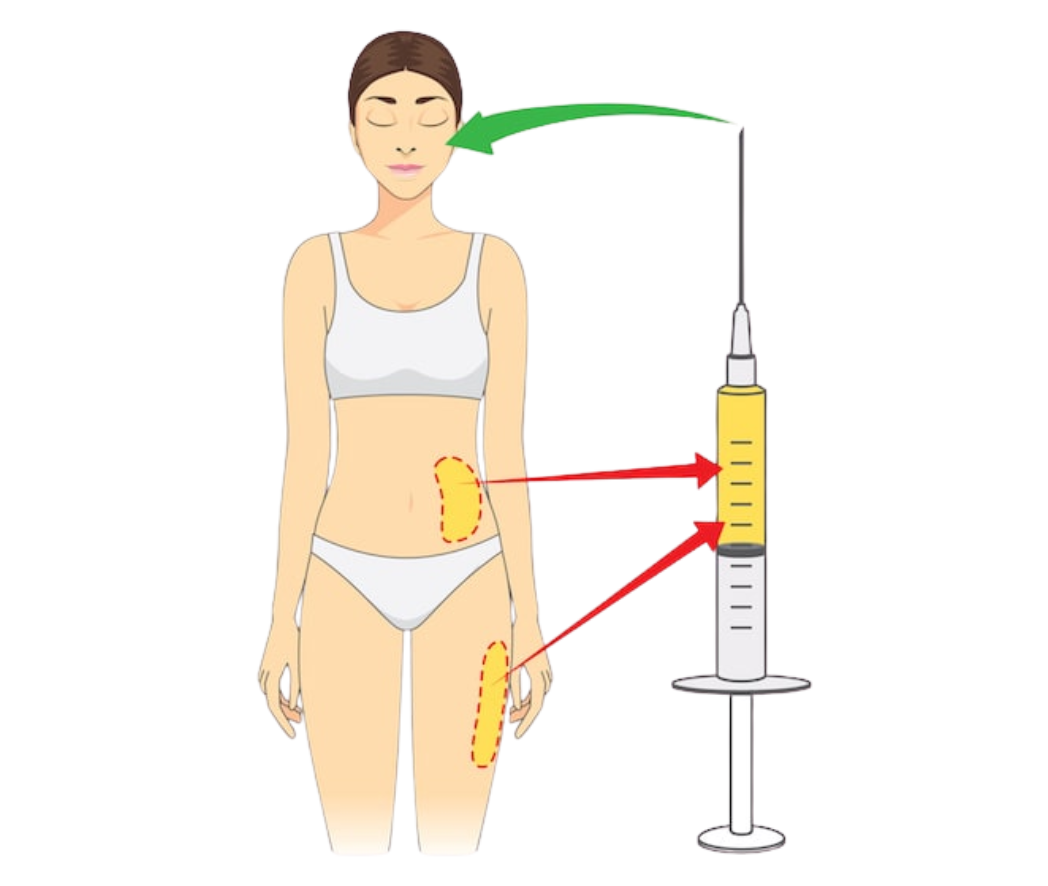 hc aesthetics-cabinet-lipofiling
