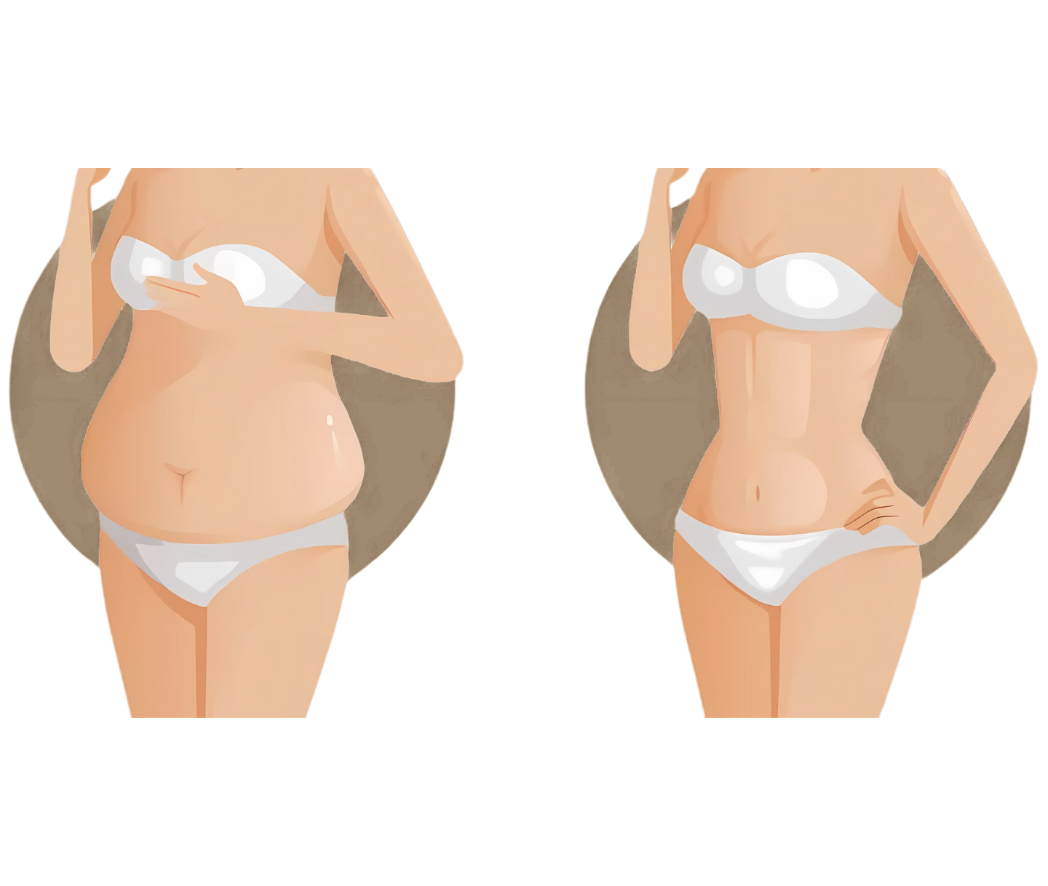 hc aesthetics-cabinet-mommy makeover