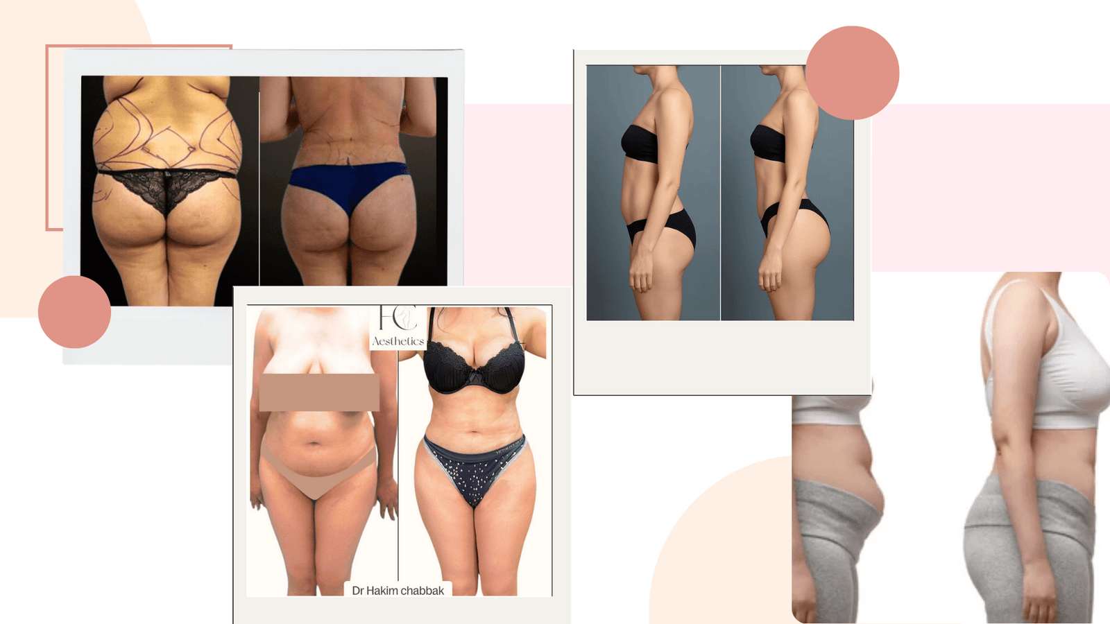 Chirurgien esthétique à Casablanca