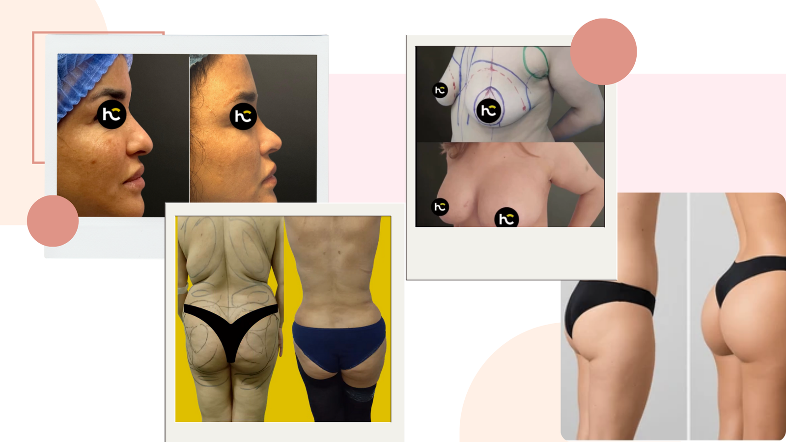 meilleur chirurgien esthétique à Casablanca